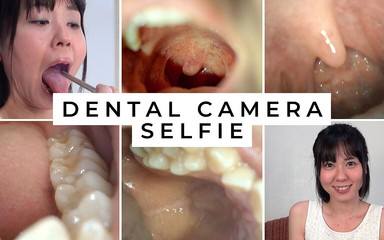 Dental Camera Selfie, Marika Naruse