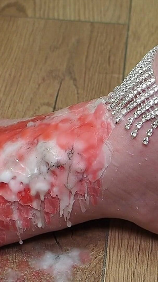 Silent Magic: Wax Removal From the Foot