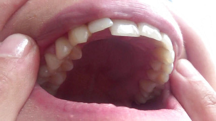 Kate open her mouth wide for you