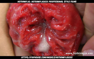 Hotkinkyjo Bottle Anal Insertion and Prolapse Push Out