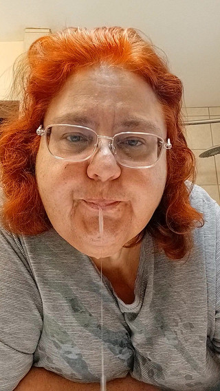 Ate Too Much and Nose a Mess