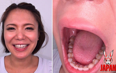 Teeth Examination - Beauty Unveiled