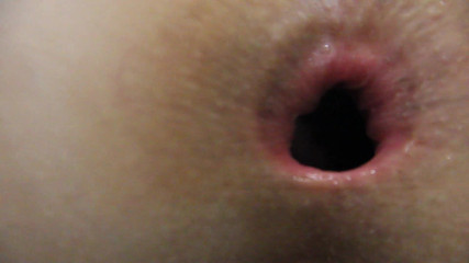 Asshole Is Playing with You, Close-up